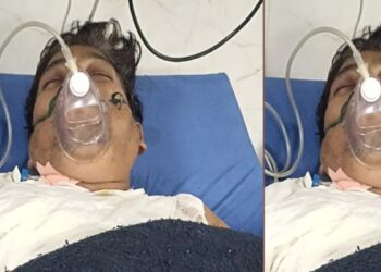 पर्वतीय कॉलोनी निवासी व्यक्ति महेश को आग लगाने के मामले में एसीपी क्राइम अमन यादव की अध्यक्षता में एसआईटी टीम गठित